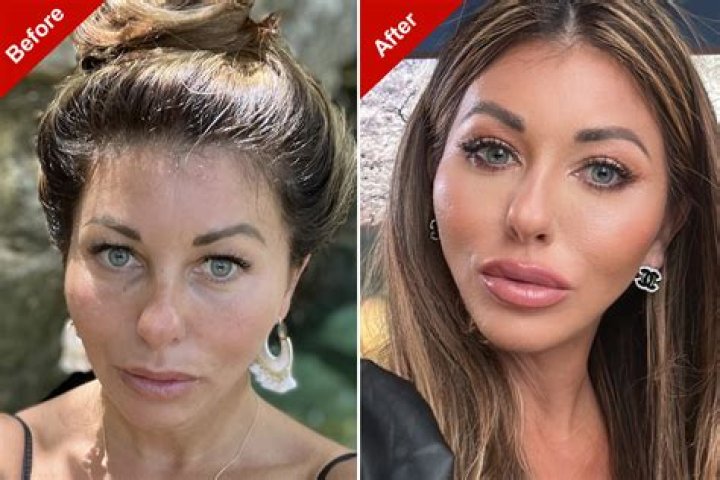 Carli Bybel's Plastic Surgery Journey Explored