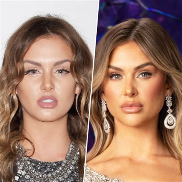 Vanderpump Rules Star Reveals More Plastic Surgery Hollywood Life