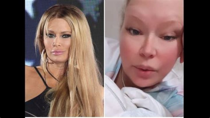 Jenna Jameson Illness: Symptoms, Causes, And Treatment